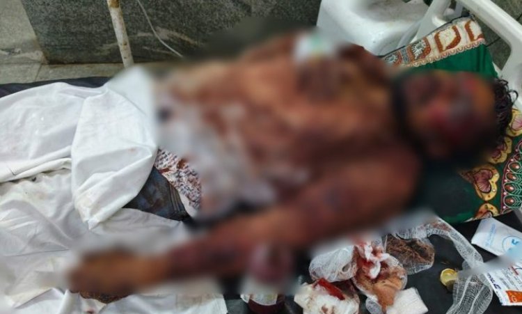 CG Crime : दोस्त, दोस्त ना रहा.! 3 दोस्तों ने दोस्त पर चाकू से किया ताबड़तोड़ हमला...फिर खेत में फेंककर हुए फरार...लहूलुहान तड़पता रहा रातभर...पढ़ें पूरी खबर