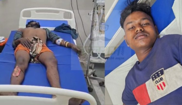 बड़ा हादसा.! खेत में काम के दौरान 11kV तार की चपेट में आने से बुरी तरह झुलसे..इलाज जारी..पढ़ें पूरी खबर