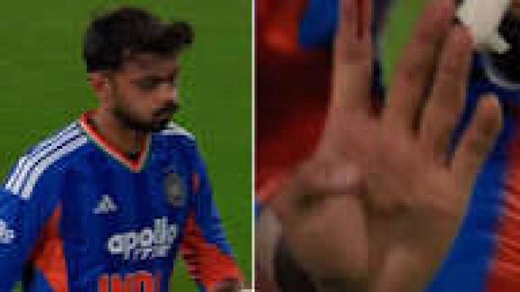 न्यूजीलैंड के खिलाफ उंगली में गंभीर चोट लगने के बाद दर्द में मैदान छोड़कर गए अक्षर पटेल