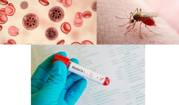 Malaria Cases: मलेरिया का कहर! 37 वर्षीय महिला ने इलाज के दौरान तोड़ा दम